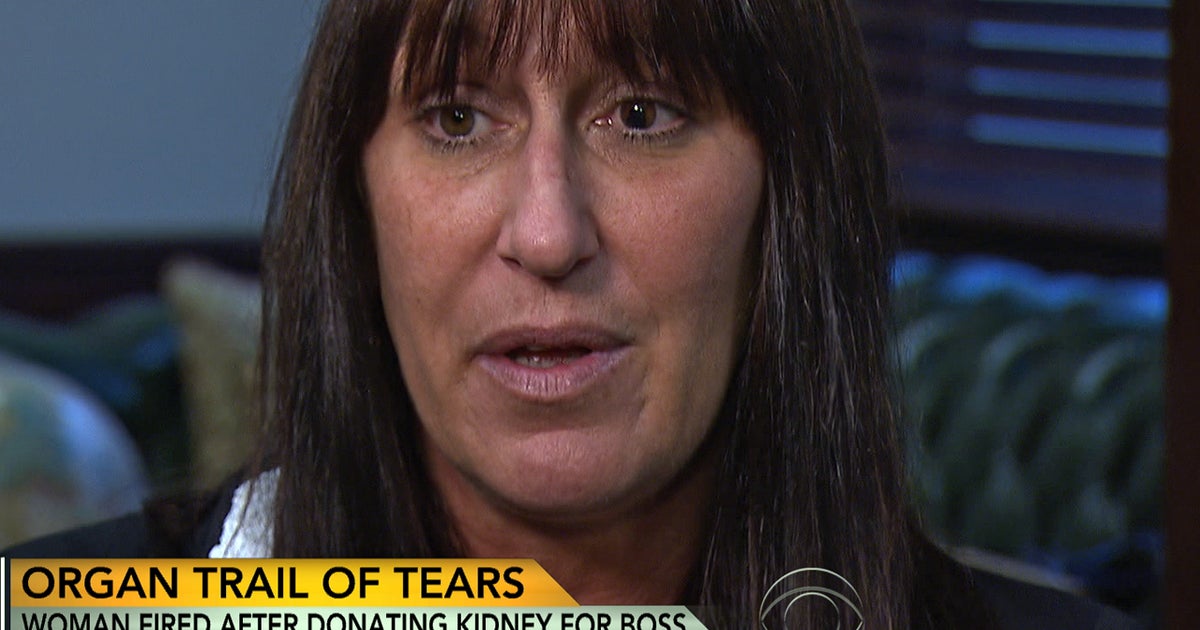 Suit: Woman fired after donating kidney for boss - CBS News