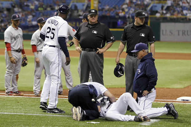 Joe Maddon watches as the training staff tends to Will Rhymes after he collapsed at first base 