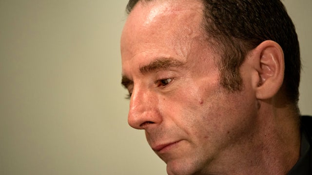 Man "cured" of AIDS: Timothy Ray Brown