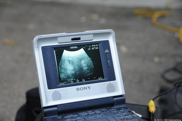 Ultrasound_2012.jpg 
