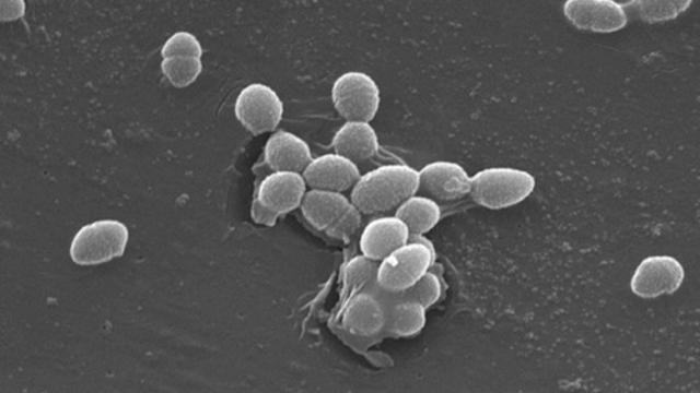 gut-bacteria.jpg 