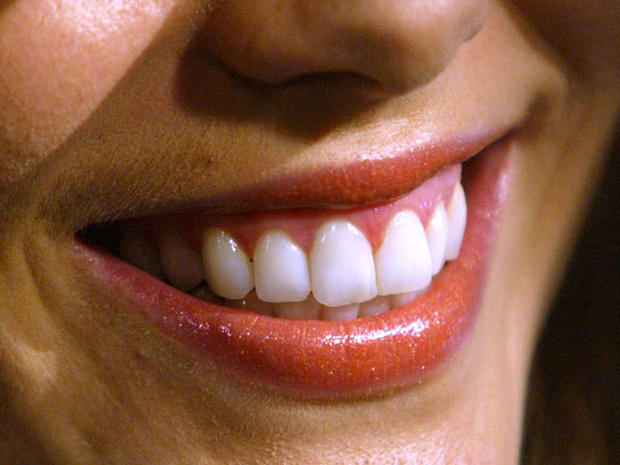white teeth 