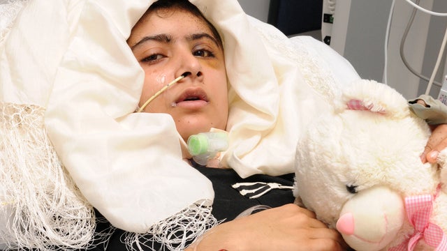 10/15: Malala Yousafzai to make "decent recovery;" JFK's Cuban missile crisis artifacts revealed 