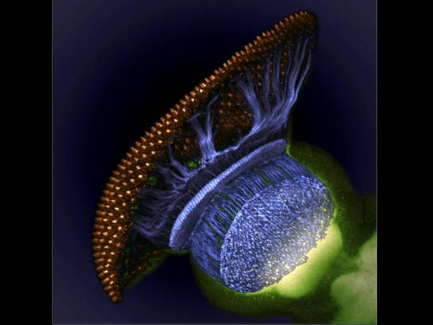 Drosophila melanogaster visual system halfway through pupal development, showing retina (gold), photoreceptor axons (blue), and brain (green)(1500x) 
