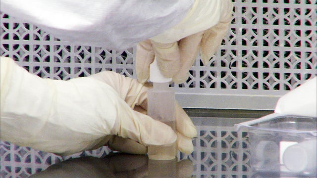 FDA's alarming findings in meningitis probe 