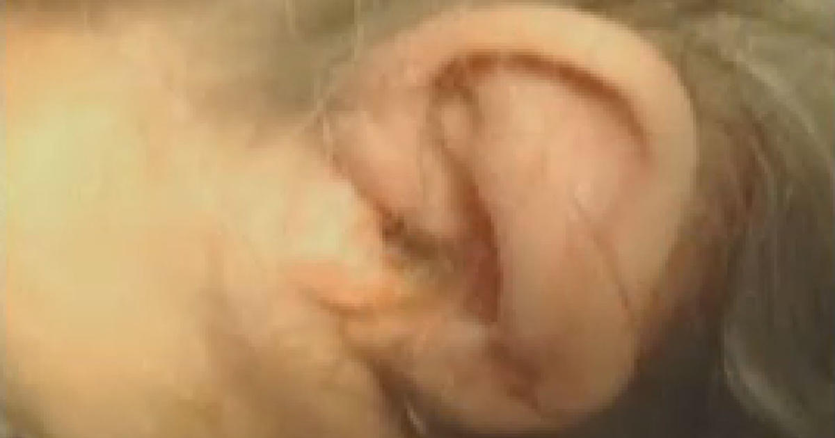 92-year-old has 57 maggots removed from ear, family sues nursing home - CBS  News