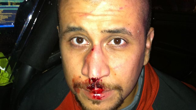 This photograph shows George Zimmerman, accused of killing unarmed teen Trayvon Martin, the night of their confrontation. It was made public by Zimmerman's lawyers on December 3, 2012. 
