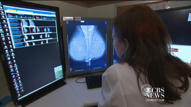 Tamoxifen study suggests extending treatment 