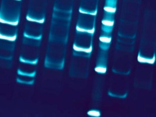 DNA Sample Test 