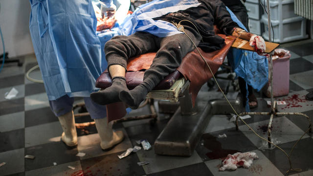 syria, wounded, war crime, hospital 