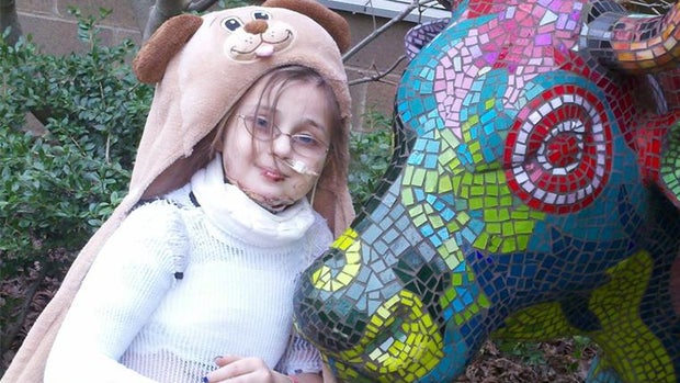 Cancer survivor set on fire by hand sanitizer