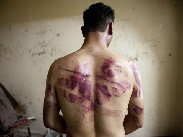 syria, torture 