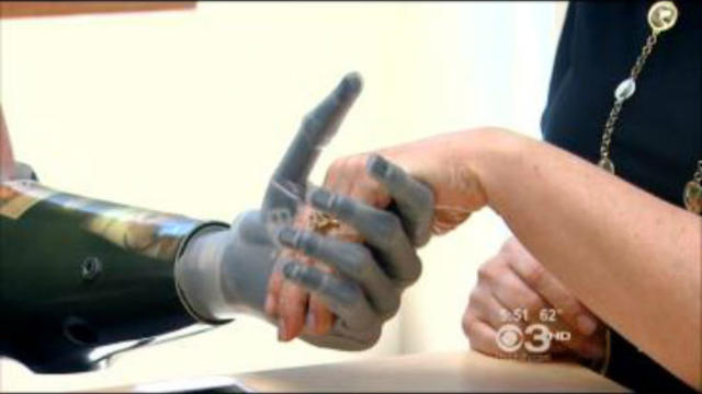 bionic-hand1.jpg 