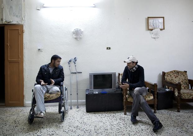 Syrian rebel fighter who lost a leg to shrapnel 