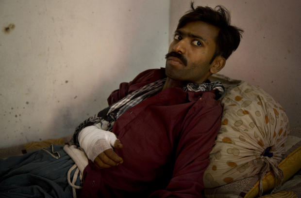 Barber Elias, 25, a Pakistani Christian who was beaten by radical Muslims in the Joseph Colony 