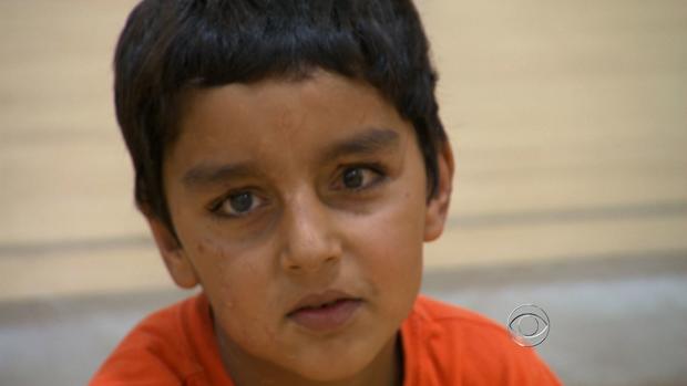 Six-year-old Sajad was badly injured in Afghanistan when a bomb went off next to his home. 