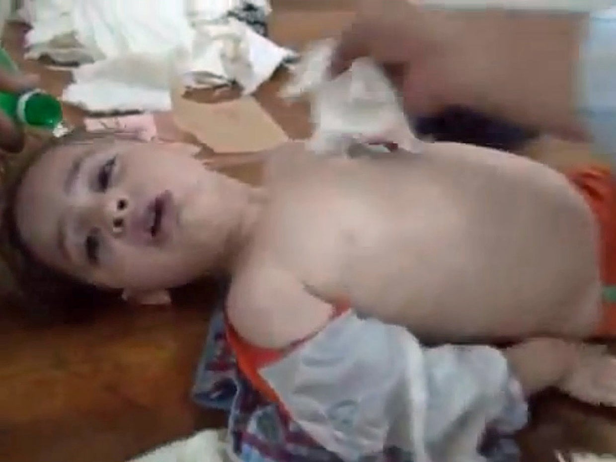 A young boy gasps for air in a makeshift hospital after an alleged chemical weapons attack on the eastern Ghouta suburbs of Damascus 