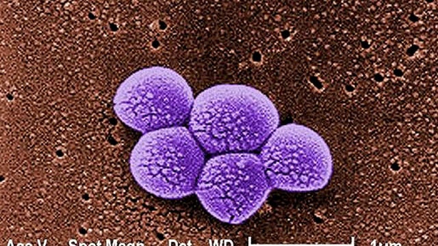MRSA.jpg 
