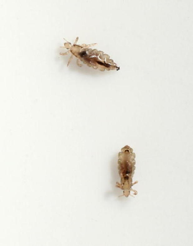 Common Head Lice 