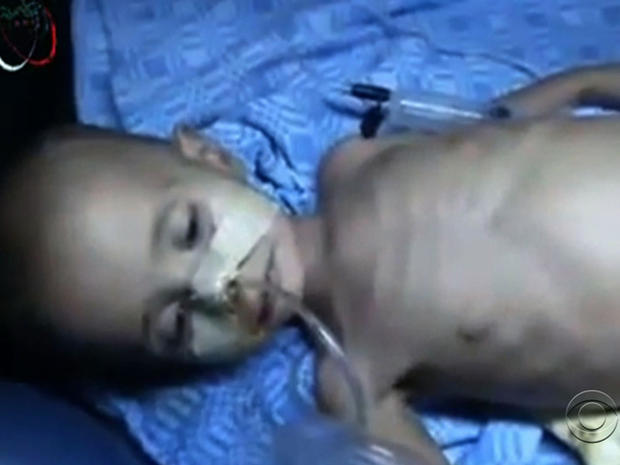 syria_children_starving_girl.jpg 