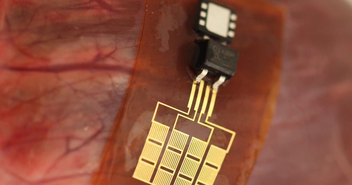 Flexible device uses heartbeat to create electrical source in body ...