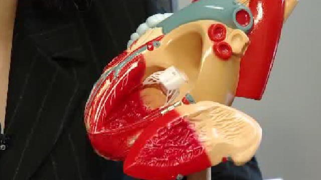 heart_valve.jpg 