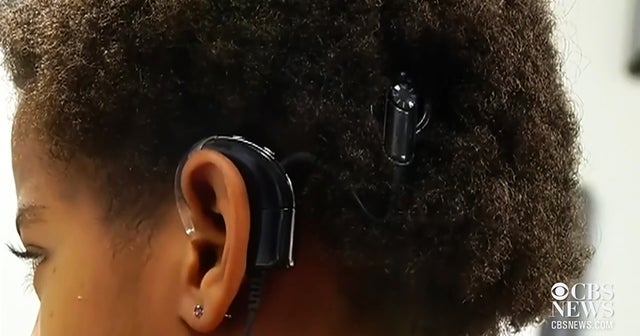 New technology helps the deaf hear - CBS News