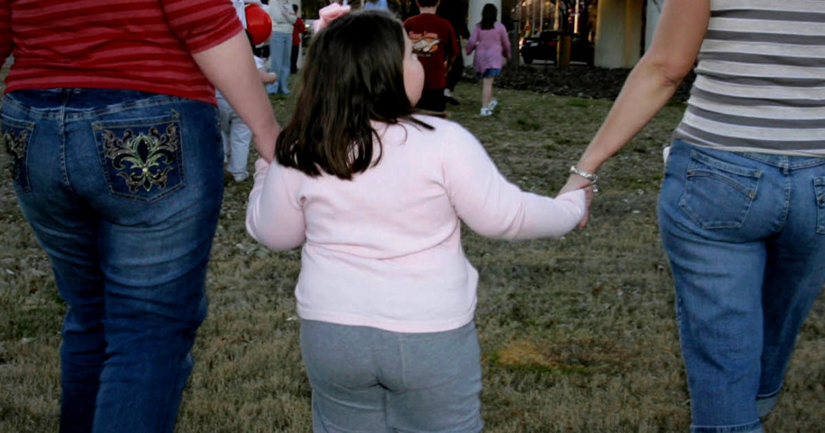 Severe childhood obesity on the rise in U.S., study shows - CBS News