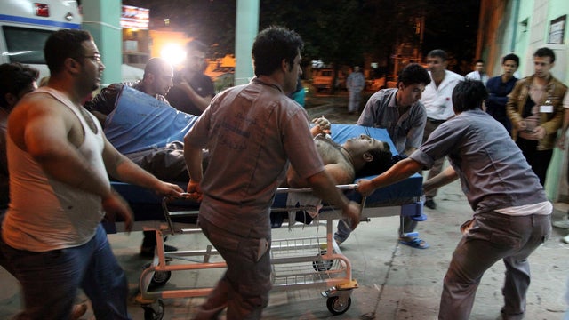 A victim of a bomb attack, which occurred in Khanaqin, is wheeled on a gurney into a hospital in Sulaimaniya 