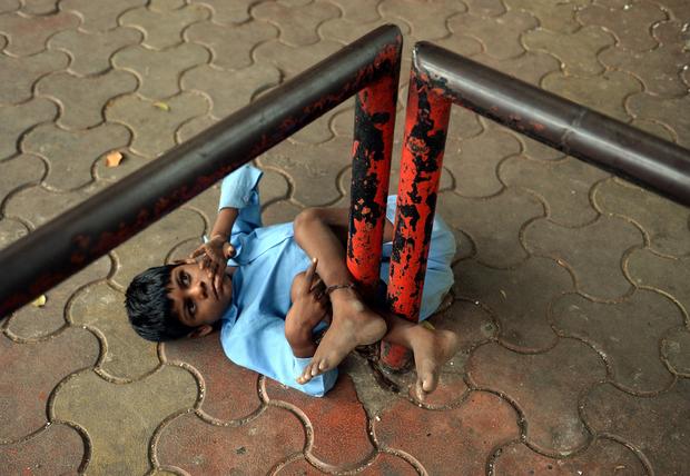 Disabled boy tied to sidewalk in India 