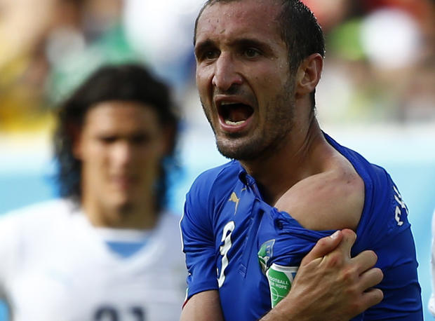Italy's Giorgio Chiellini shows his shoulder, claiming he was bitten by Uruguay's Luis Suarez, during their 2014 World Cup Group D soccer match at the Dunas arena in Natal, Brazil on June 24, 2014 
