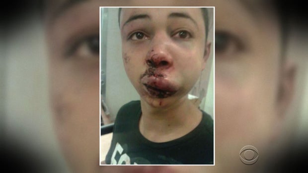 beatenpalestinianboy.jpg 