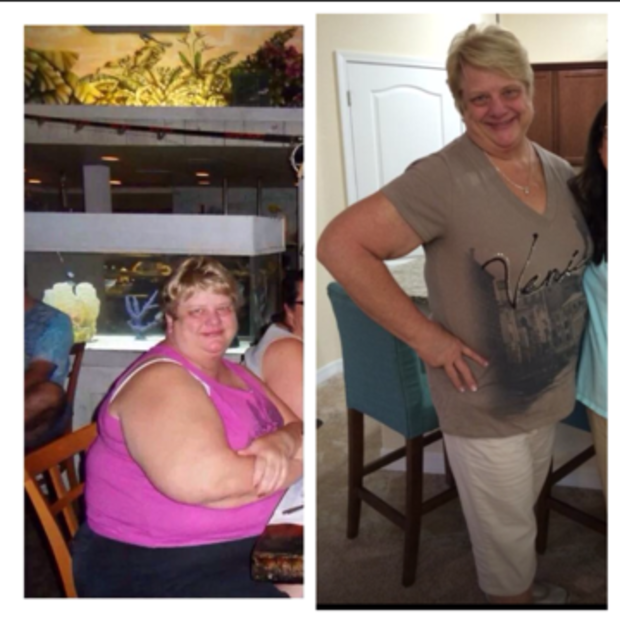 Barbara before and after 100 lbs 