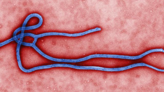 ebola_virus_virion.jpg 