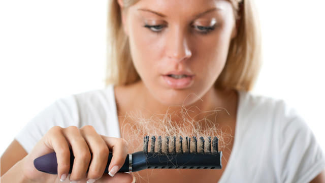 women_s_hair_loss.jpg 