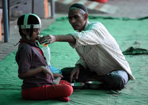An Indian resident feeds Umar, a second-generation victim of the Bhopal gas disaster, at the Chingari Trust, an organization working to help the second-generation victims of the disaster, near the Union Carbide factory in Bhopal Nov. 30, 2014. 