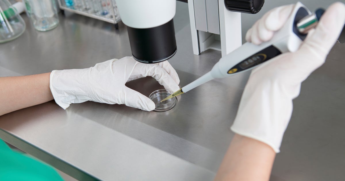 Multiple Sclerosis Treatment Stem Cell Transplant May Help Patients