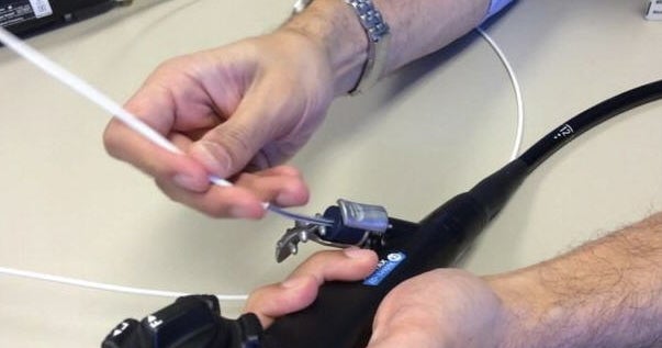 Specialized endoscope design linked to "superbug" bacteria transmission