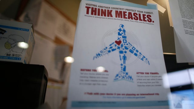 measles poster 