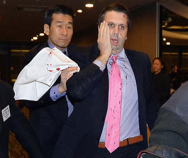 In handout image provided by The Asia Economy Daily newspaper, U.S. Ambassador to South Korea Mark Lippert is seen after getting attacked on March 5, 2015 in Seoul, South Korea 