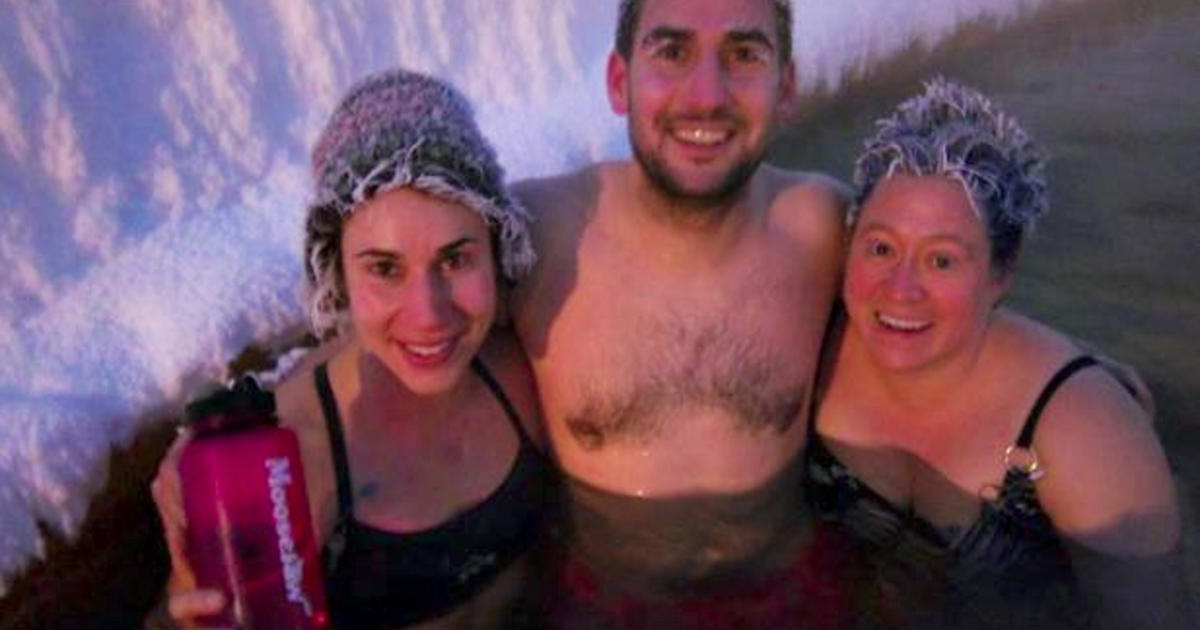 Canada's crazy frozen hair contest in Takhini Hot Springs