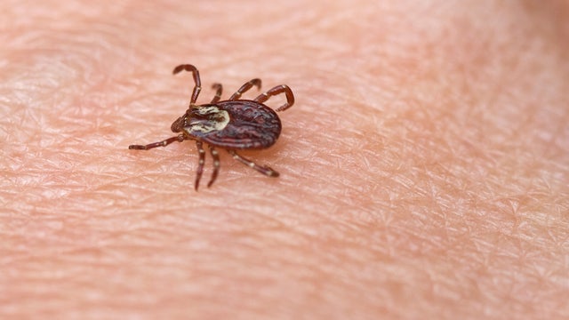tick-insect-on-skin.jpg 
