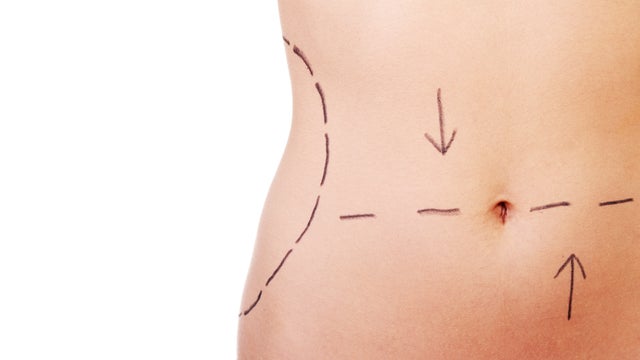 Latest trends in plastic surgery 