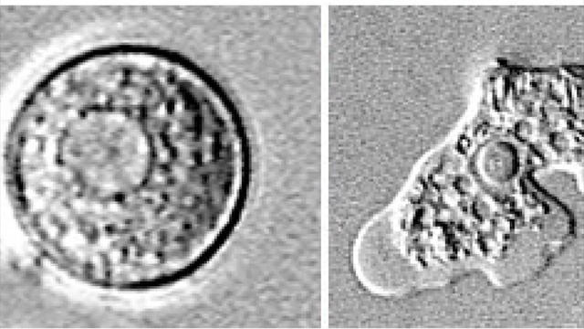 0821healthbraineatingamoeba1435985640x360.jpg 