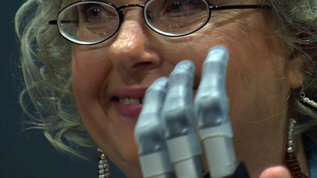 bionicfingers911640x360.jpg 