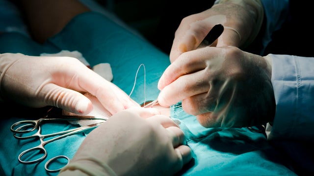 surgeons-surgery-operating-room.jpg 