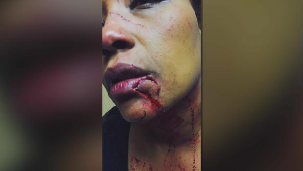 Asma Jama - Victim Of Applebee's Attack 