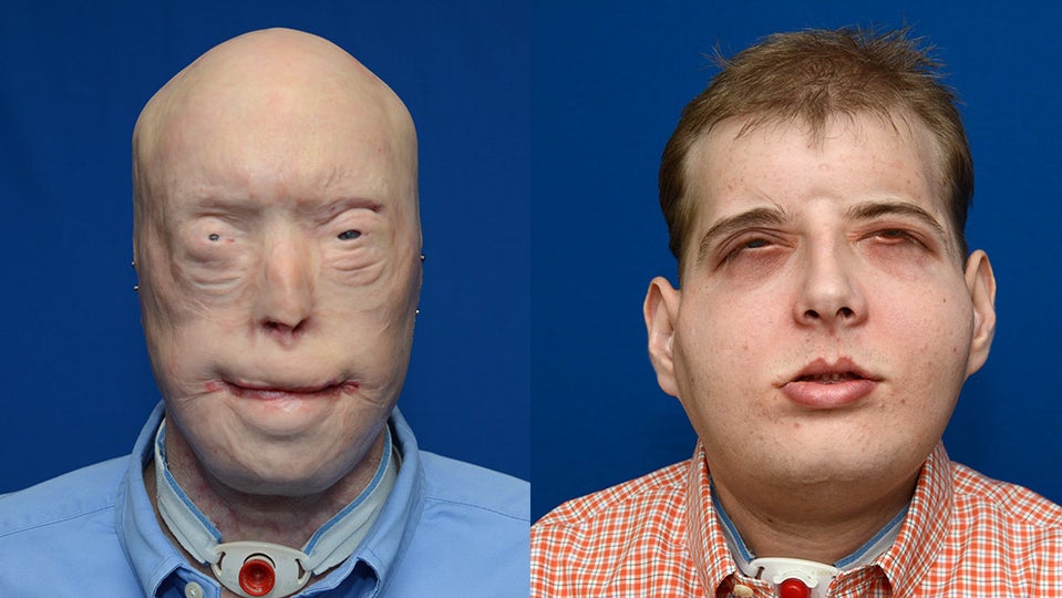 patrick-hardison-before-and-after.jpg 