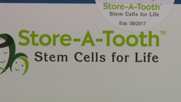 STORE A TOOTH  (2) 