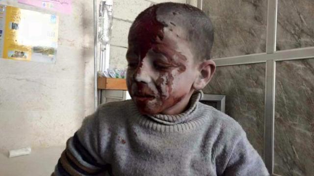 ​An image posted to Twitter by user @HadiAlabdallah shows a Syrian boy allegedly injured in a Russian airstrike that hit a school in the town of Ain Jara, west of Aleppo 